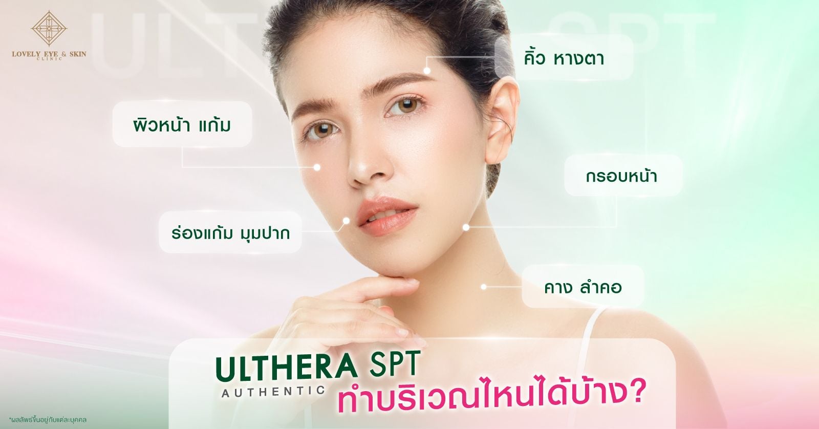 ทำ Ulthera บริเวณไหนได้บ้าง คิ้ว หางตา ช่วยยกคิ้ว ยกหางตา