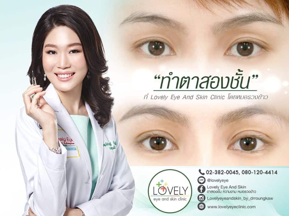 ทําตาสองชั้น เทคนิคเลิฟลี่อาย โดยคุณหมอรวงข้าว_2.jpg