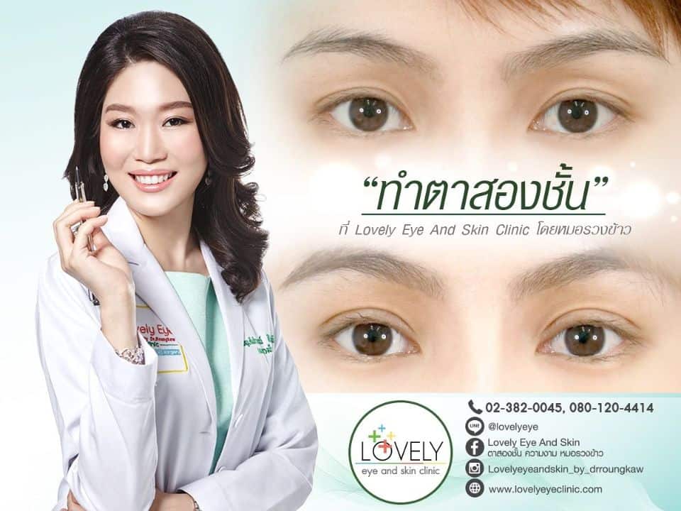 Double eyelid surgery Lovely eye technique by Dr.Roungkaw